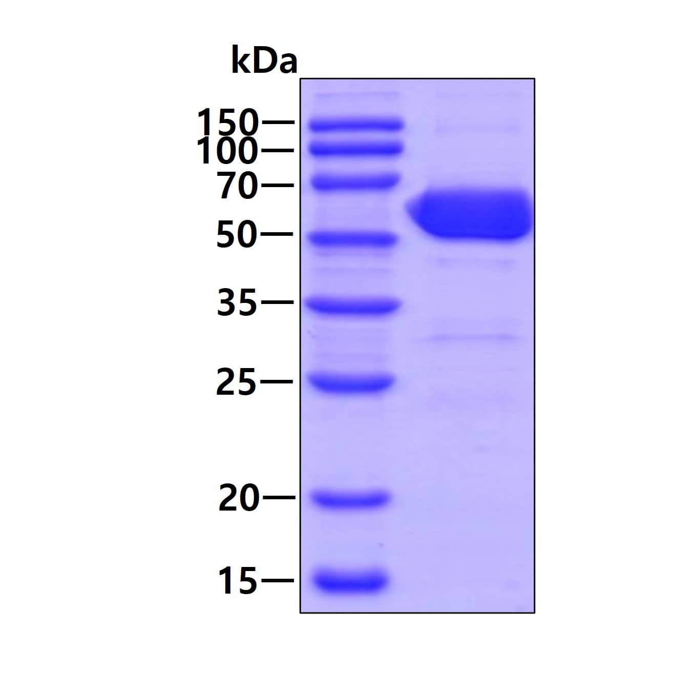 Recombinant Human Importin alpha 2/KPNA2 His Protein