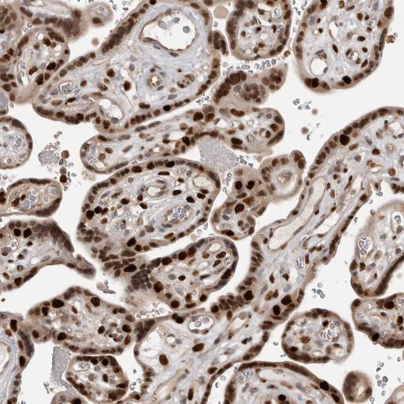 ZIM2 Antibody Immunohistochemistry: ZIM2 Antibody [NBP1-80590]