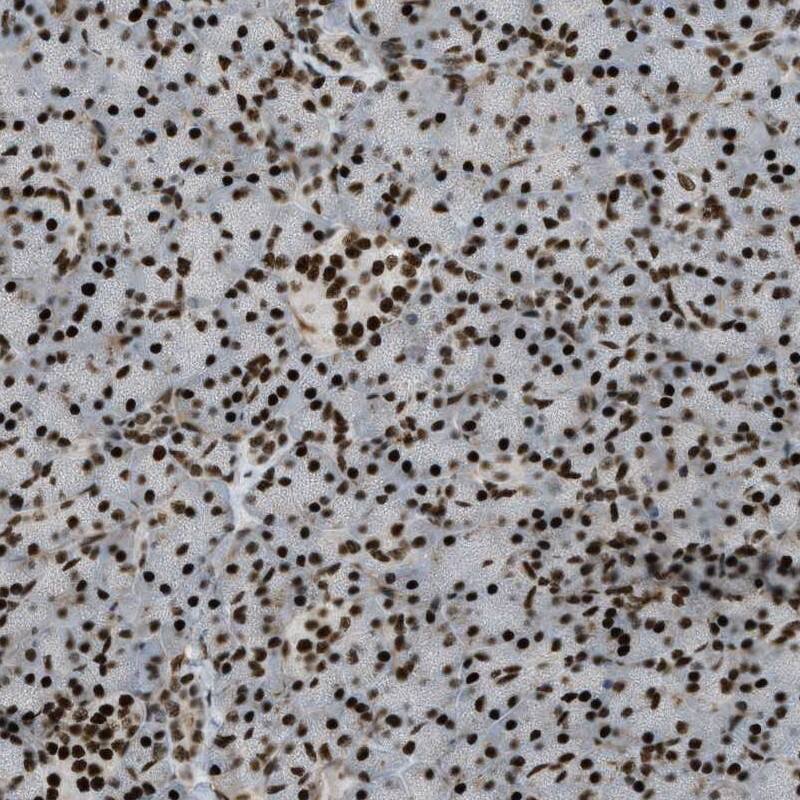 ZFR Antibody - BSA Free Immunohistochemistry-Paraffin: ZFR Antibody [NBP1-80601]