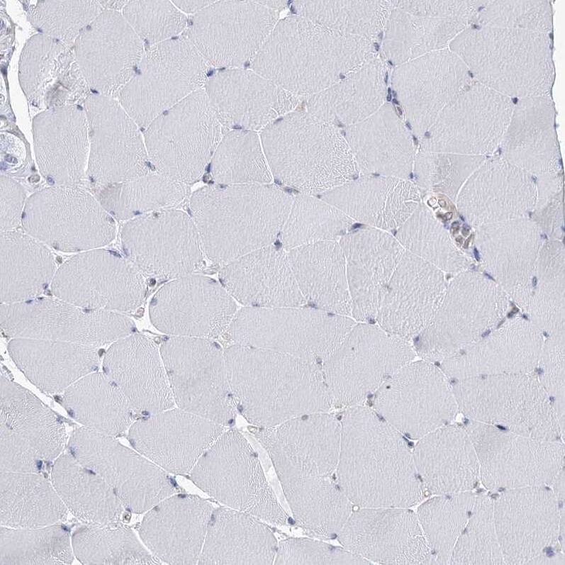 USP11 Antibody - BSA Free Immunohistochemistry-Paraffin: USP11 Antibody [NBP1-80639]