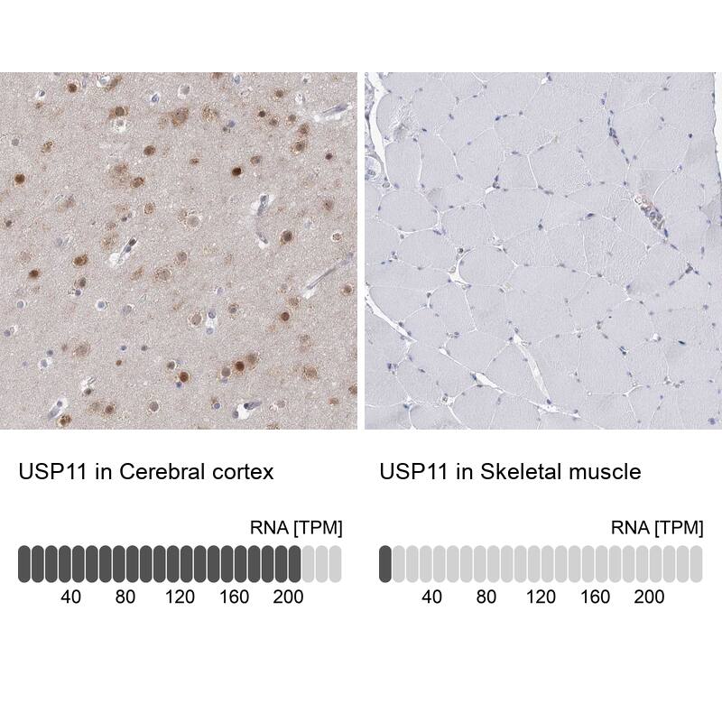 USP11 Antibody - BSA Free Immunohistochemistry-Paraffin: USP11 Antibody [NBP1-80639]