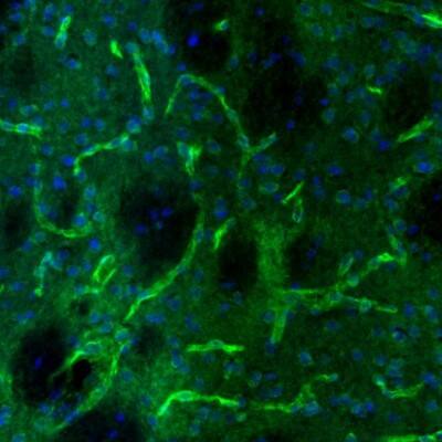 USP11 Antibody - BSA Free Immunohistochemistry-Paraffin: USP11 Antibody [NBP1-80639]