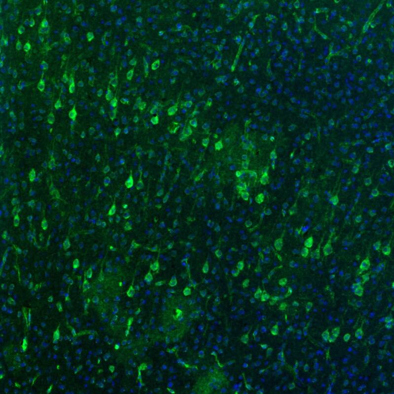 USP11 Antibody - BSA Free Immunohistochemistry-Paraffin: USP11 Antibody [NBP1-80639]