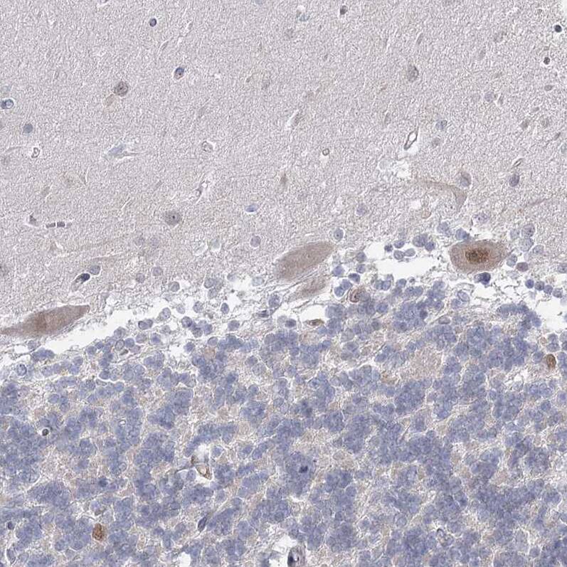 USP11 Antibody - BSA Free Immunohistochemistry-Paraffin: USP11 Antibody [NBP1-80639]
