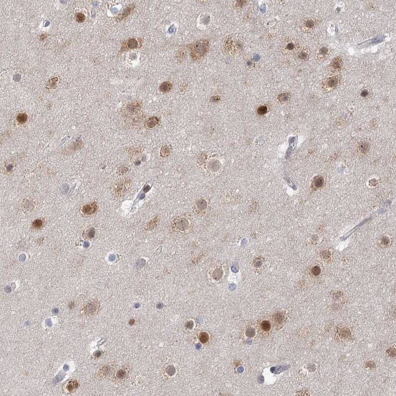 USP11 Antibody - BSA Free Immunohistochemistry-Paraffin: USP11 Antibody [NBP1-80639]