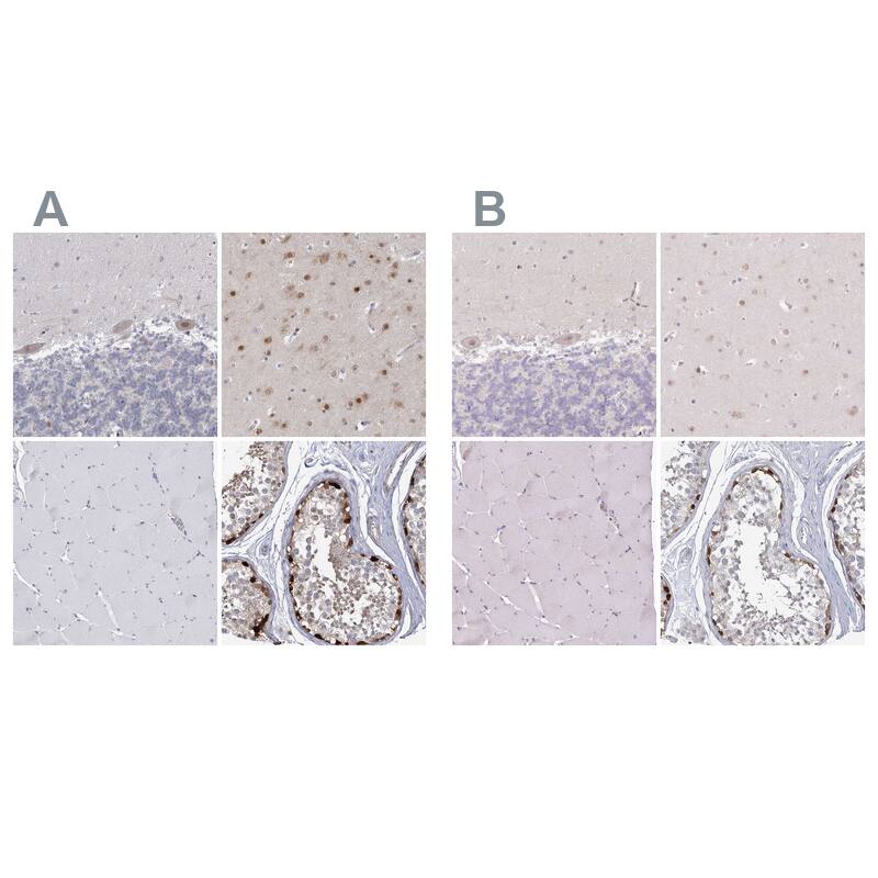 USP11 Antibody - BSA Free Immunohistochemistry-Paraffin: USP11 Antibody [NBP1-80639]