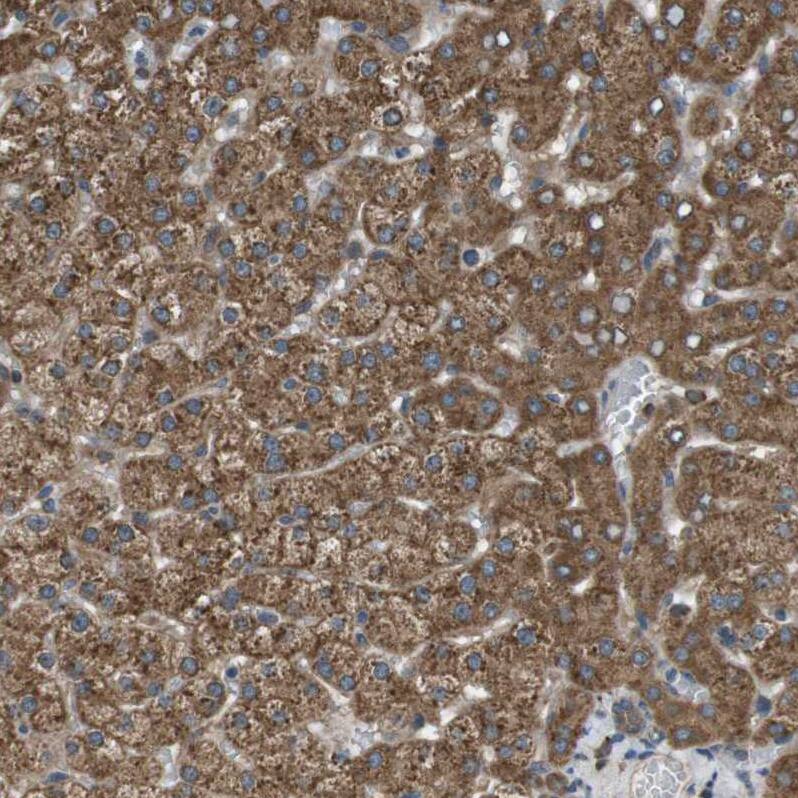 SSR3 Antibody - BSA Free Immunohistochemistry-Paraffin: SSR3 Antibody [NBP1-80667]