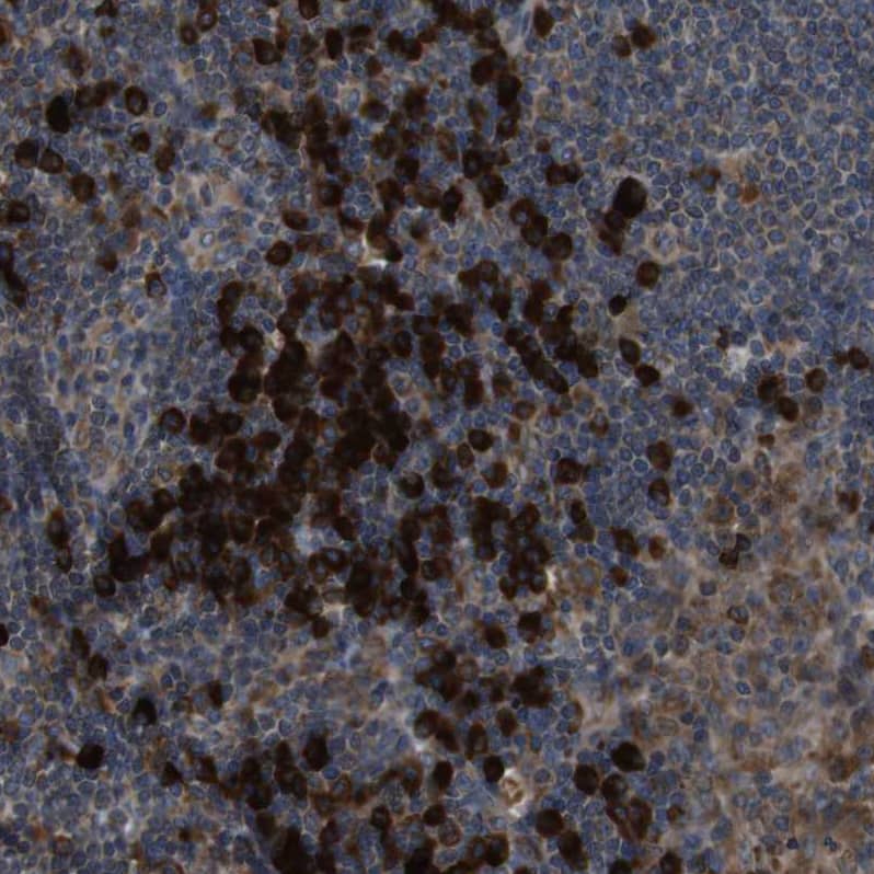 SSR3 Antibody - BSA Free Immunohistochemistry-Paraffin: SSR3 Antibody [NBP1-80667]