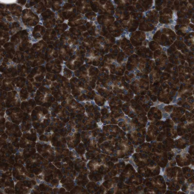 SSR3 Antibody - BSA Free Immunohistochemistry-Paraffin: SSR3 Antibody [NBP1-80667]