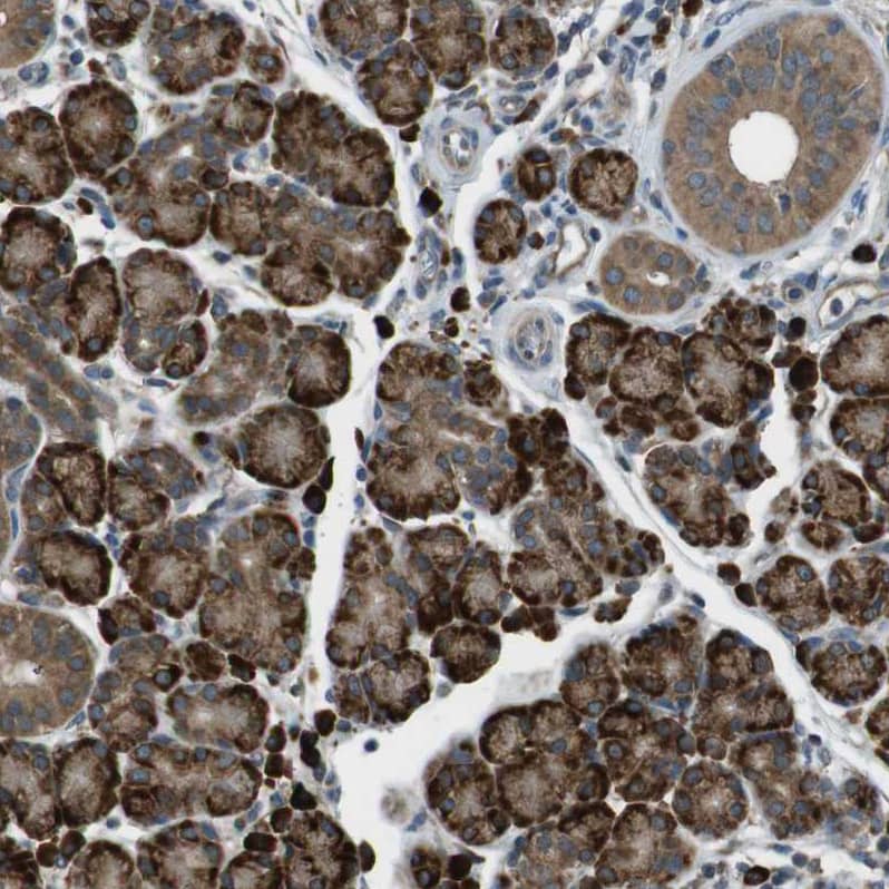 SSR3 Antibody - BSA Free Immunohistochemistry-Paraffin: SSR3 Antibody [NBP1-80667]