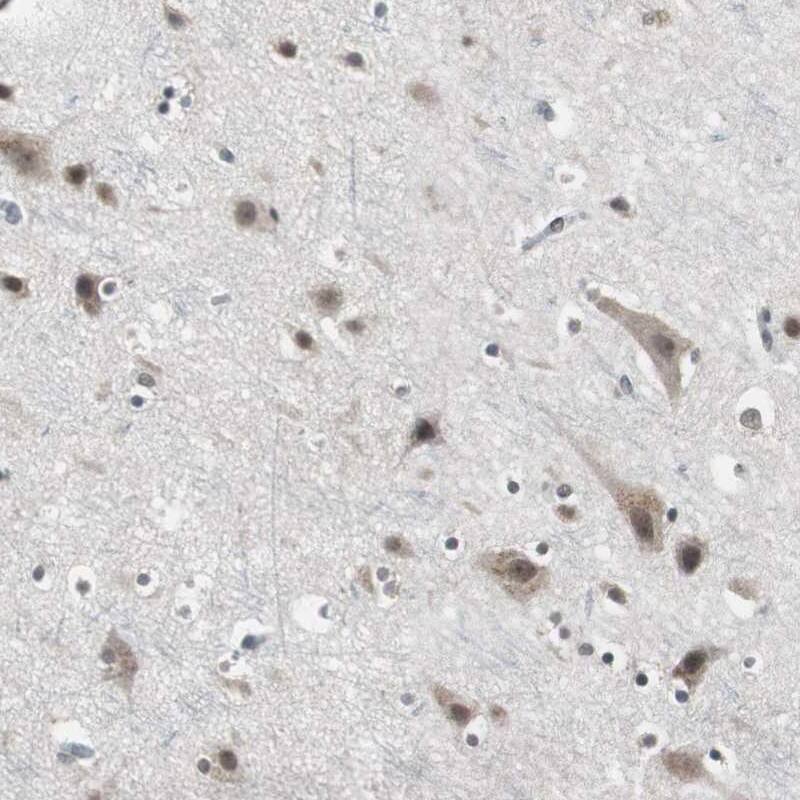 TAF7 Antibody - BSA Free Immunohistochemistry-Paraffin: TAF7 Antibody [NBP1-80704]