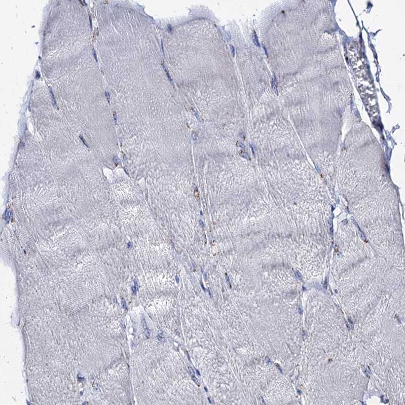 Tm9sf3 Antibody - BSA Free Immunohistochemistry-Paraffin: Tm9sf3 Antibody [NBP1-80736]