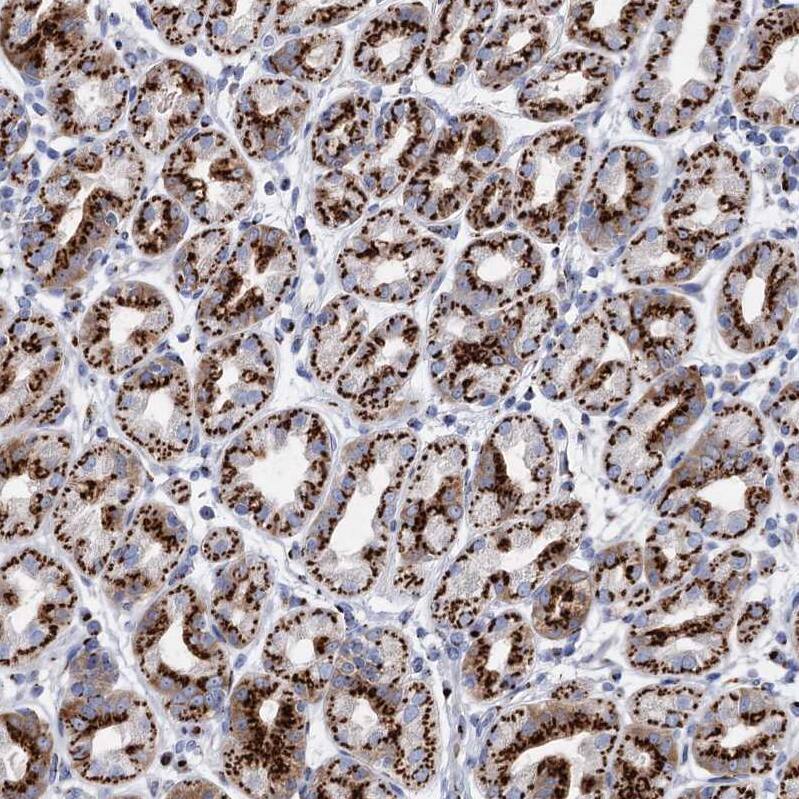 Tm9sf3 Antibody - BSA Free Immunohistochemistry-Paraffin: Tm9sf3 Antibody [NBP1-80736]