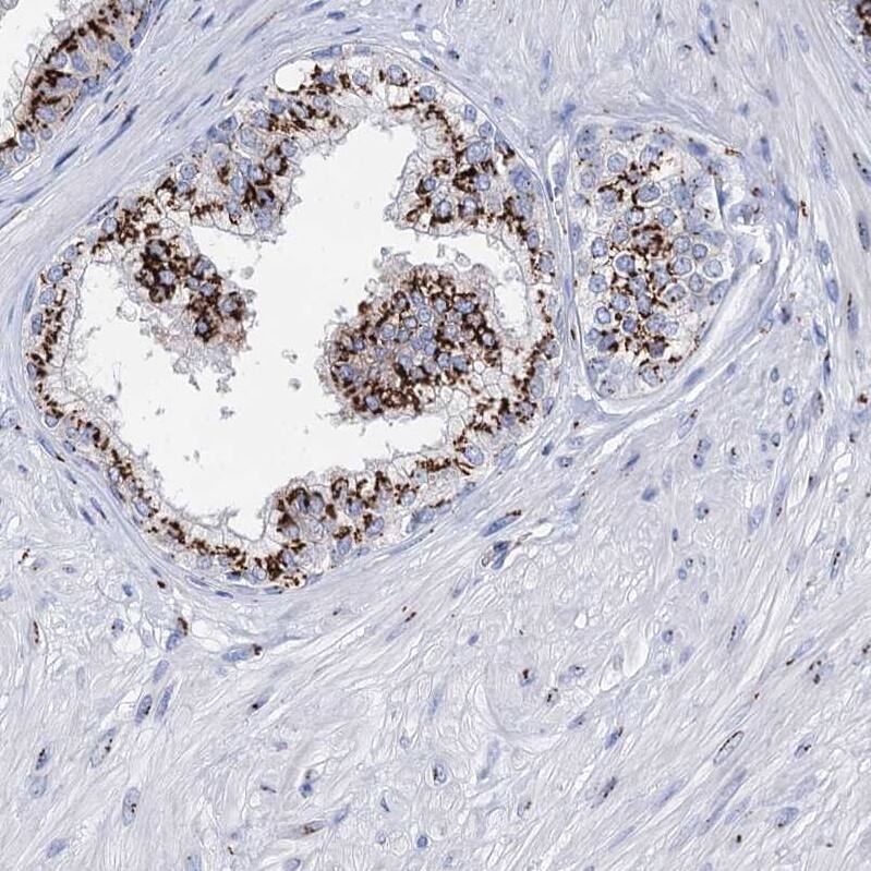 Tm9sf3 Antibody - BSA Free Immunohistochemistry-Paraffin: Tm9sf3 Antibody [NBP1-80736]