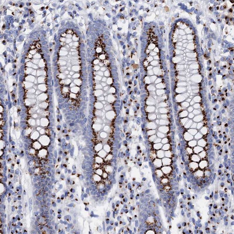 Tm9sf3 Antibody - BSA Free Immunohistochemistry-Paraffin: Tm9sf3 Antibody [NBP1-80736]