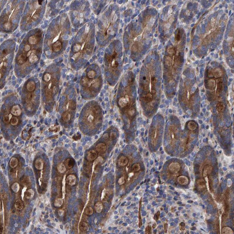 Slit2 Antibody - BSA Free Immunohistochemistry: Slit2 Antibody - BSA Free [NBP1-80742]