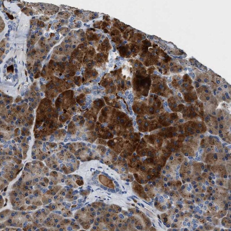 Slit2 Antibody - BSA Free Immunohistochemistry: Slit2 Antibody - BSA Free [NBP1-80743]