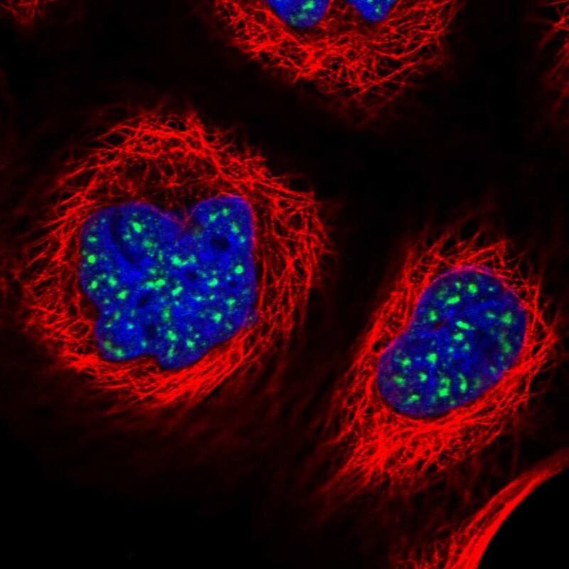 ZNF695 Antibody - BSA Free Immunocytochemistry/ Immunofluorescence: ZNF695 Antibody [NBP1-80783]