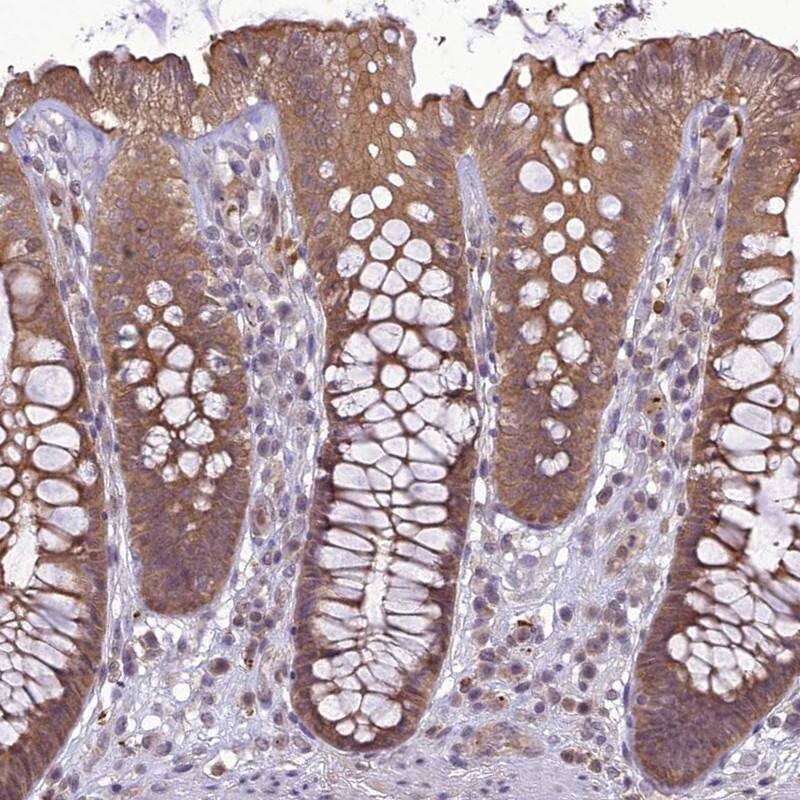 TIGD7 Antibody - BSA Free Immunohistochemistry-Paraffin: TIGD7 Antibody [NBP1-80790]