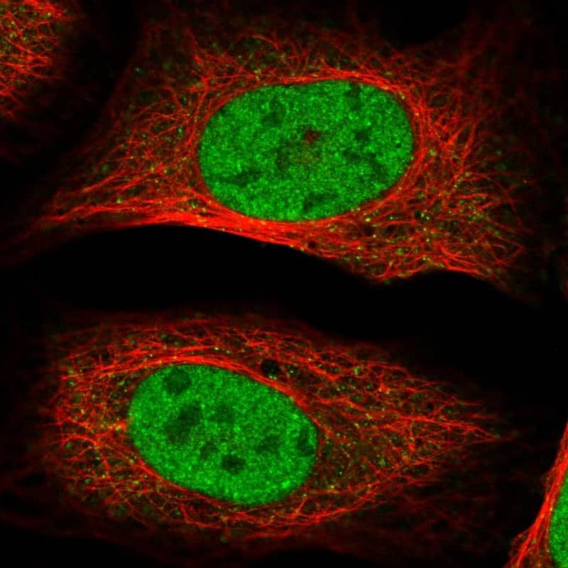 RSC1A1 Antibody - BSA Free Immunocytochemistry/ Immunofluorescence: RSC1A1 Antibody [NBP1-80811]