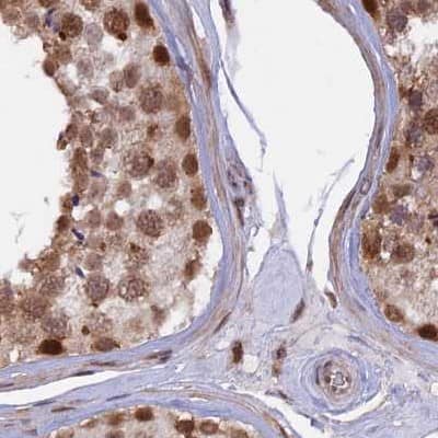 POLR2C Antibody - BSA Free Immunohistochemistry-Paraffin: POLR2C Antibody [NBP1-80817]