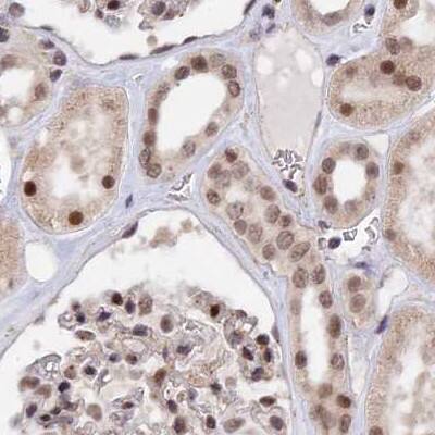 POLR2C Antibody - BSA Free Immunohistochemistry-Paraffin: POLR2C Antibody [NBP1-80817]