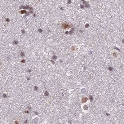 POLR2C Antibody - BSA Free Immunohistochemistry-Paraffin: POLR2C Antibody [NBP1-80817]