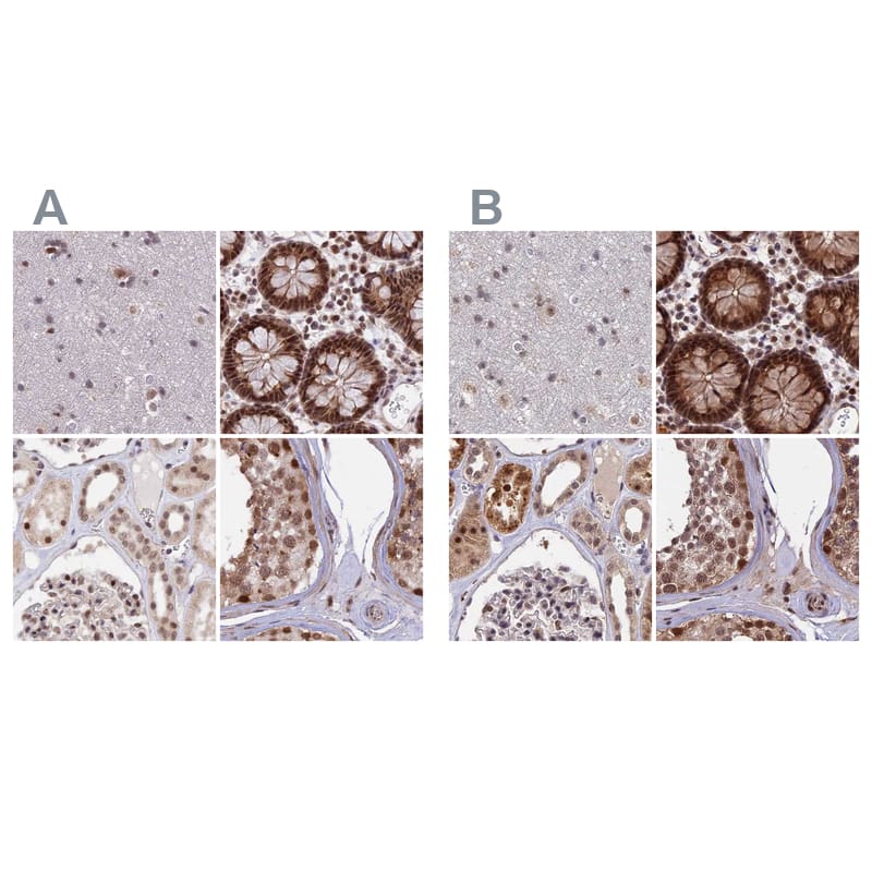 POLR2C Antibody - BSA Free Immunohistochemistry-Paraffin: POLR2C Antibody [NBP1-80817]