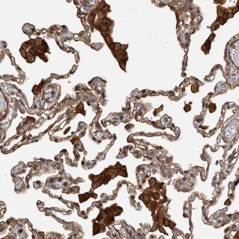 TRIM56 Antibody - BSA Free Immunohistochemistry-Paraffin: TRIM56 Antibody [NBP1-80829]
