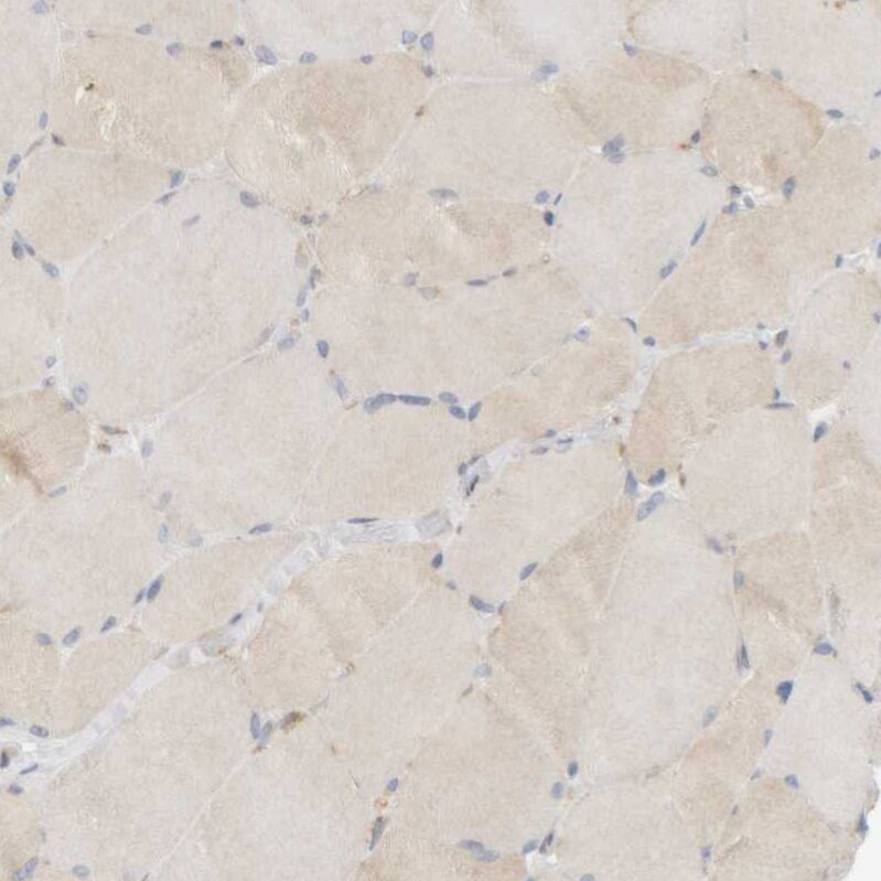 Ribophorin II Antibody - BSA Free Immunohistochemistry-Paraffin: Ribophorin II Antibody [NBP1-80835]