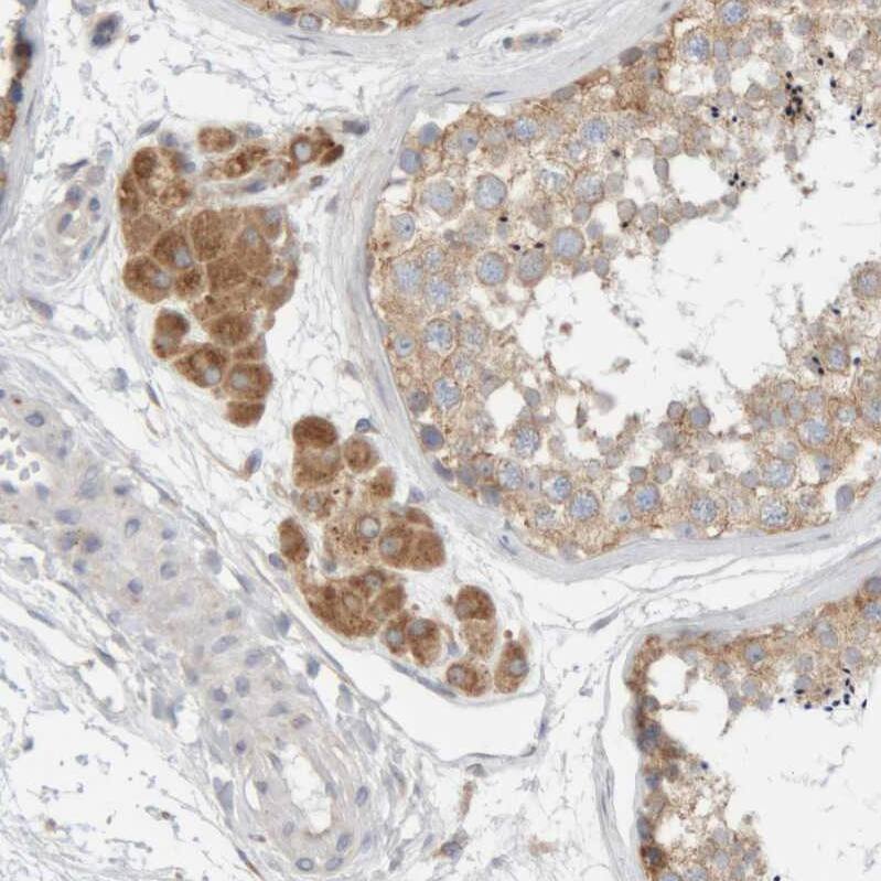 Ribophorin II Antibody - BSA Free Immunohistochemistry-Paraffin: Ribophorin II Antibody [NBP1-80835]