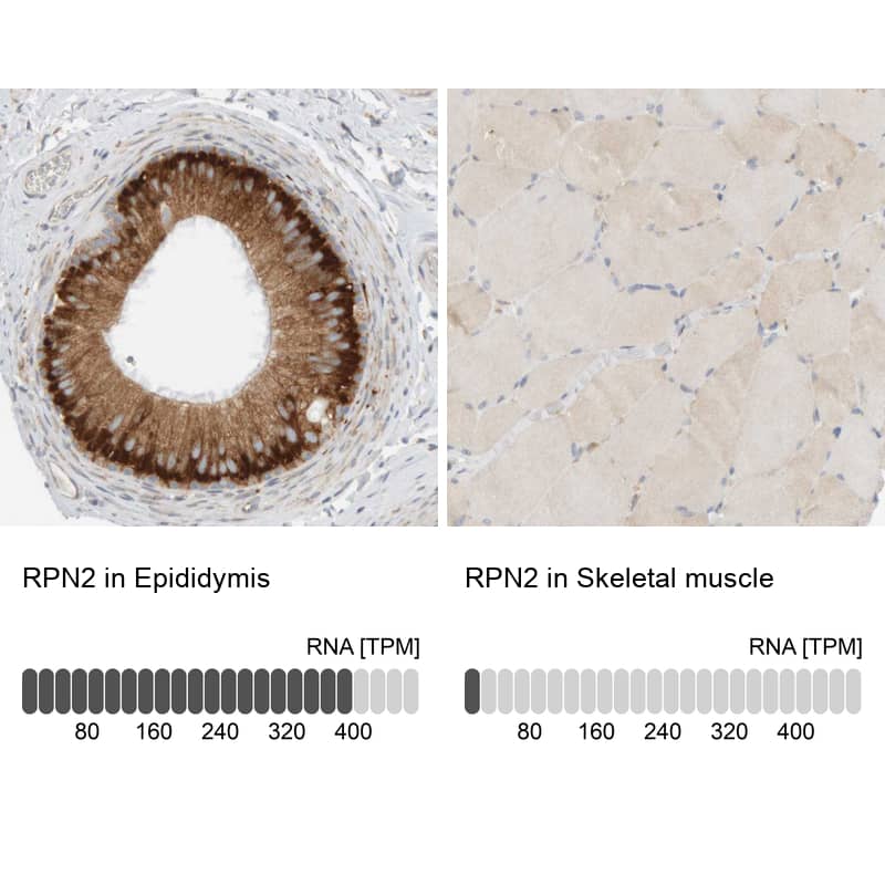 Ribophorin II Antibody - BSA Free Immunohistochemistry-Paraffin: Ribophorin II Antibody [NBP1-80835]