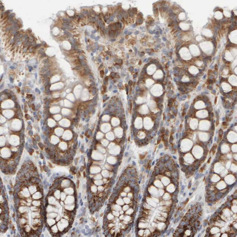 Ribophorin II Antibody - BSA Free Immunohistochemistry-Paraffin: Ribophorin II Antibody [NBP1-80835]