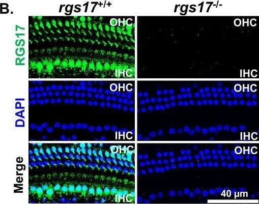RGS17 Antibody - BSA Free