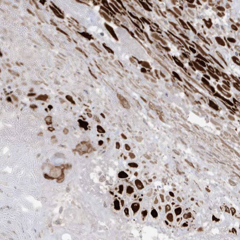 RGL4 Antibody - BSA Free Immunohistochemistry-Paraffin: RGL4 Antibody [NBP1-80840]