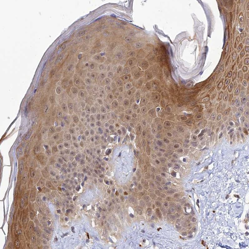 WDR61 Antibody - BSA Free Immunohistochemistry-Paraffin: WDR61 Antibody [NBP1-80844]
