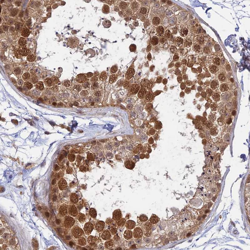 WDR61 Antibody - BSA Free Immunohistochemistry-Paraffin: WDR61 Antibody [NBP1-80844]