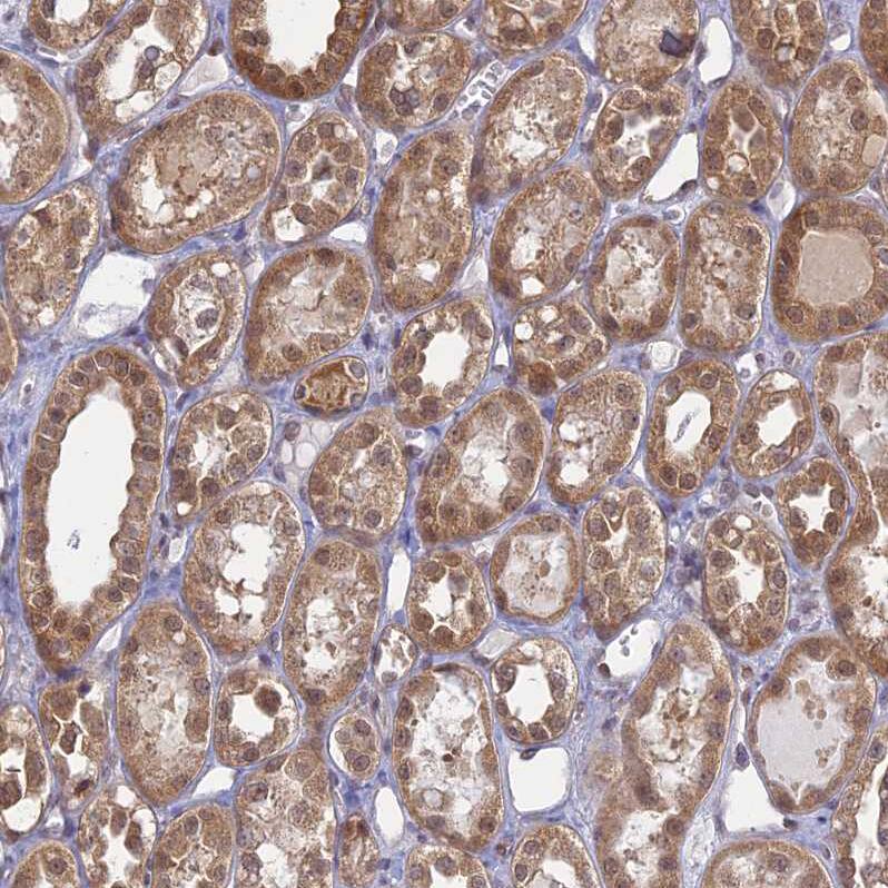 WDR61 Antibody - BSA Free Immunohistochemistry-Paraffin: WDR61 Antibody [NBP1-80844]