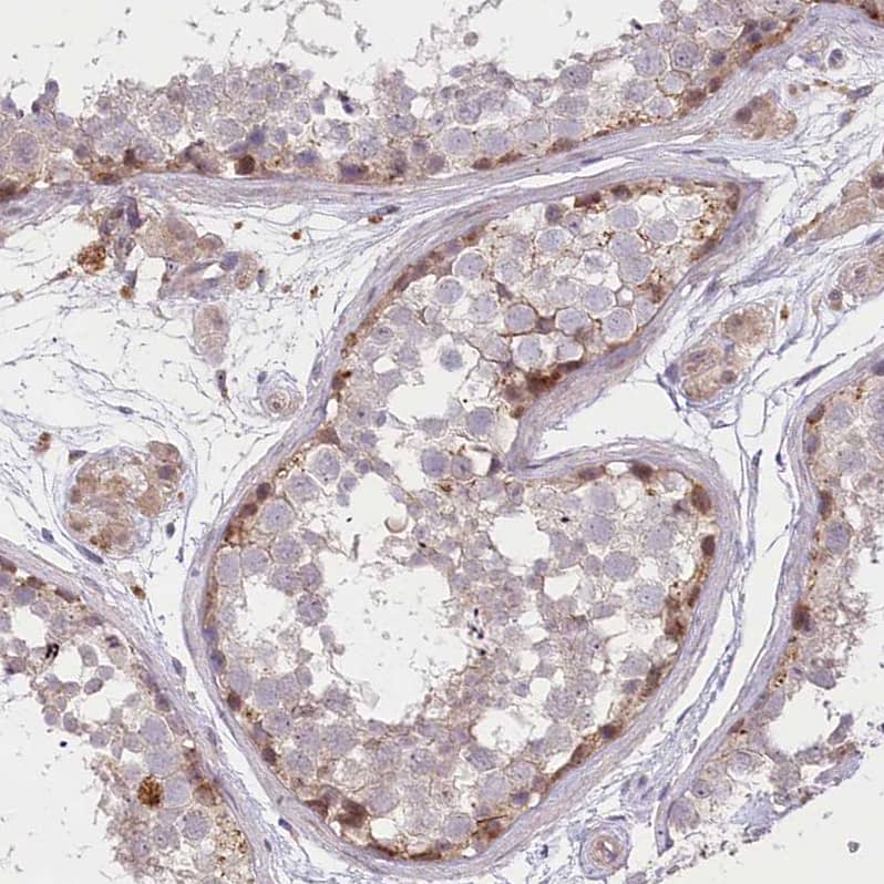 TRUB1 Antibody - BSA Free Immunohistochemistry-Paraffin: TRUB1 Antibody [NBP1-80866]