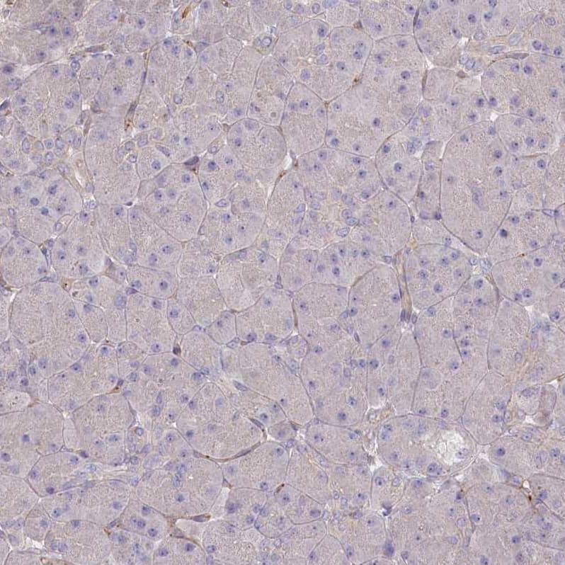 TRUB1 Antibody - BSA Free Immunohistochemistry-Paraffin: TRUB1 Antibody [NBP1-80866]