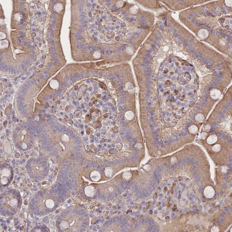 TRUB1 Antibody - BSA Free Immunohistochemistry-Paraffin: TRUB1 Antibody [NBP1-80866]
