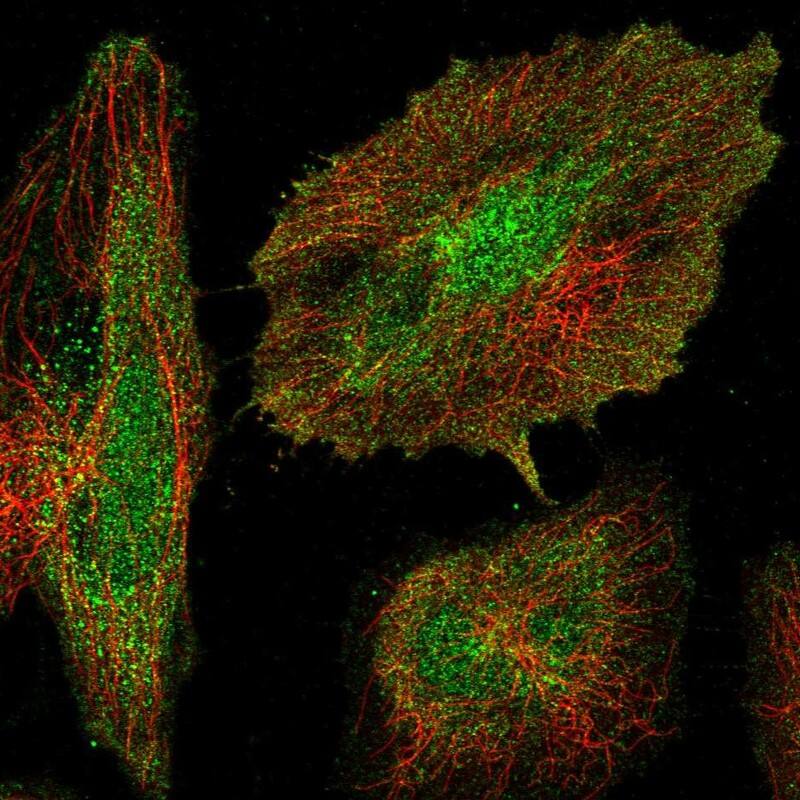 AVPI1 Antibody - BSA Free Immunocytochemistry/ Immunofluorescence: AVPI1 Antibody [NBP1-80888]
