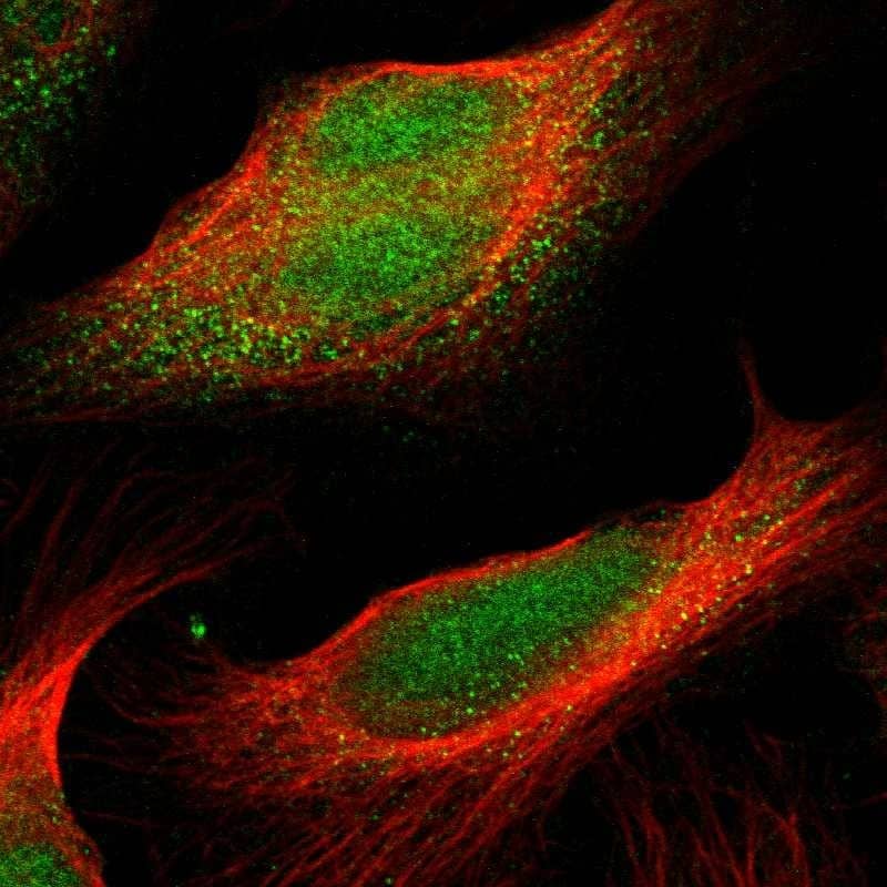 PFTK1 Antibody - BSA Free Immunocytochemistry/ Immunofluorescence: PFTK1 Antibody [NBP1-80920]