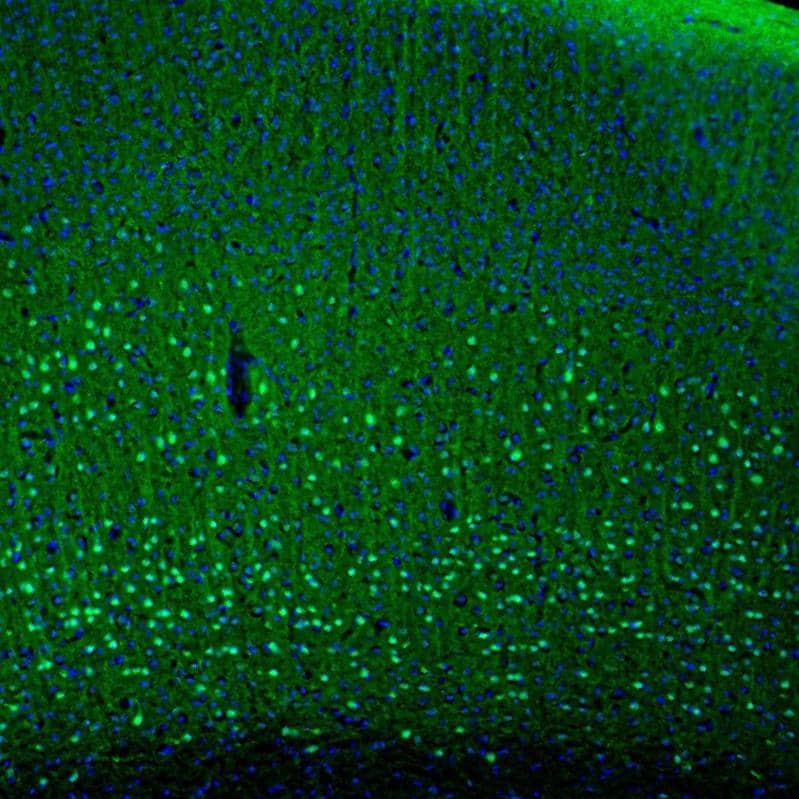 PCP4 Antibody - BSA Free Immunohistochemistry-Paraffin: PCP4 Antibody [NBP1-80929]