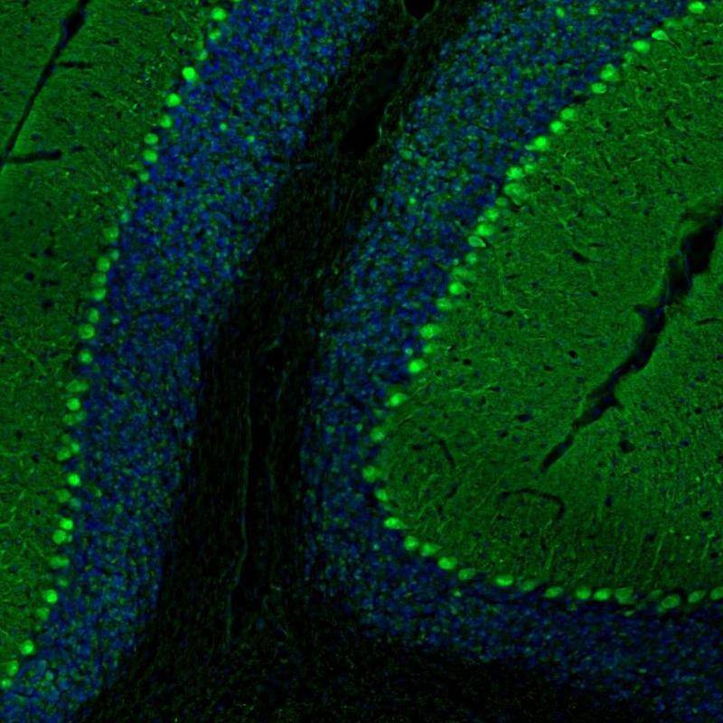PCP4 Antibody - BSA Free Immunohistochemistry-Paraffin: PCP4 Antibody [NBP1-80929]