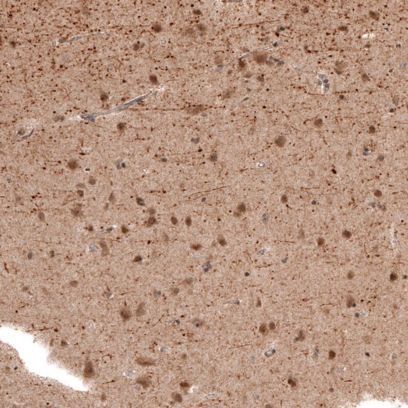 PCP4 Antibody - BSA Free Immunohistochemistry-Paraffin: PCP4 Antibody [NBP1-80929]