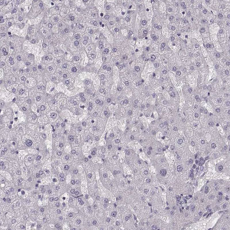 PCP4 Antibody - BSA Free Immunohistochemistry-Paraffin: PCP4 Antibody [NBP1-80929]