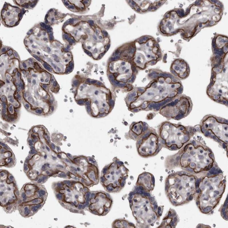 Protocadherin-17 Antibody - BSA Free Immunohistochemistry-Paraffin: Protocadherin-17 Antibody [NBP1-80943]