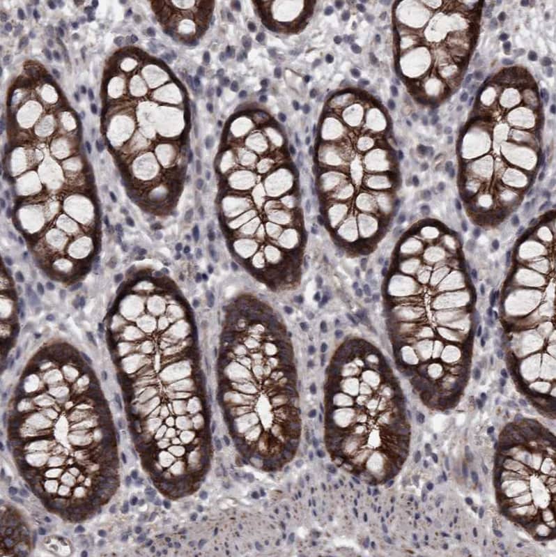 Protocadherin-17 Antibody - BSA Free Immunohistochemistry-Paraffin: Protocadherin-17 Antibody [NBP1-80943]