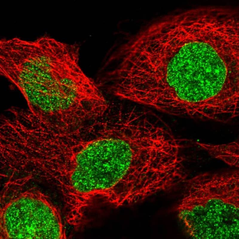 Tankyrase 1 Antibody - BSA Free Immunocytochemistry/ Immunofluorescence: Tankyrase 1 Antibody [NBP1-80947]